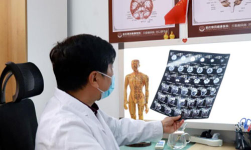 癫痫病确诊需要做几次脑电图检查?